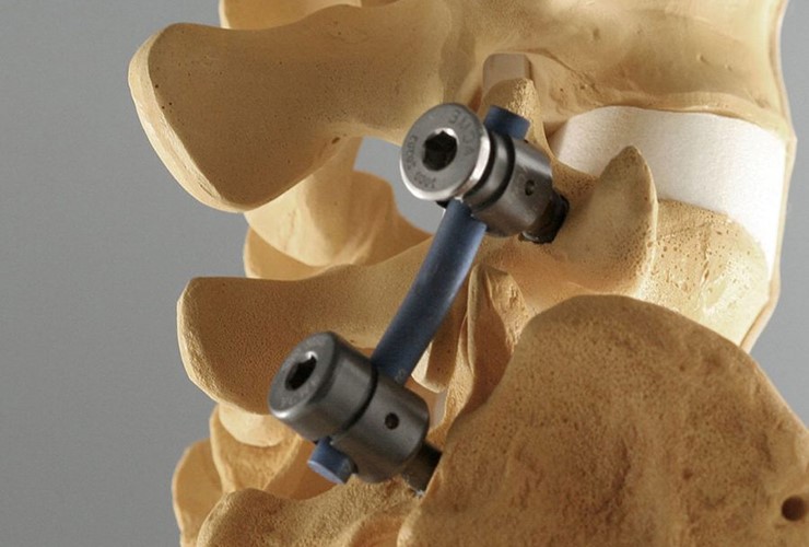 cnc machining uses in healthcare sector